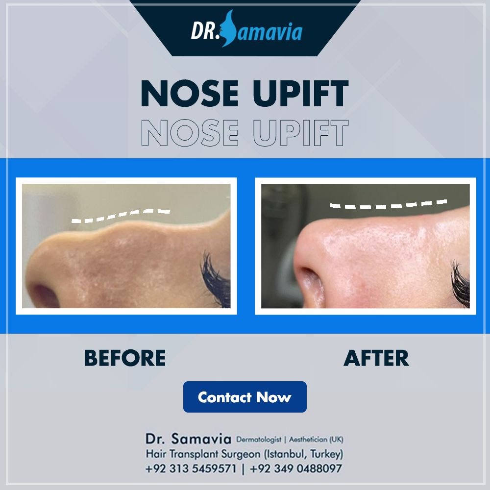 Before and after treatment result 1