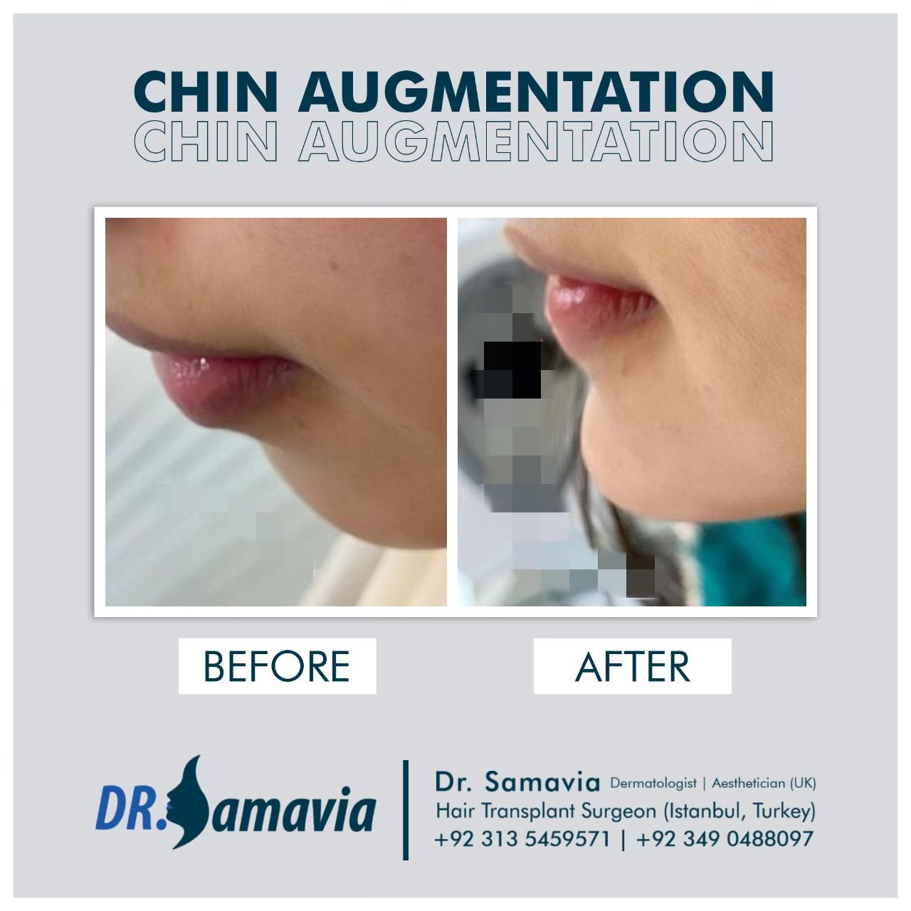 Before and after treatment result 10