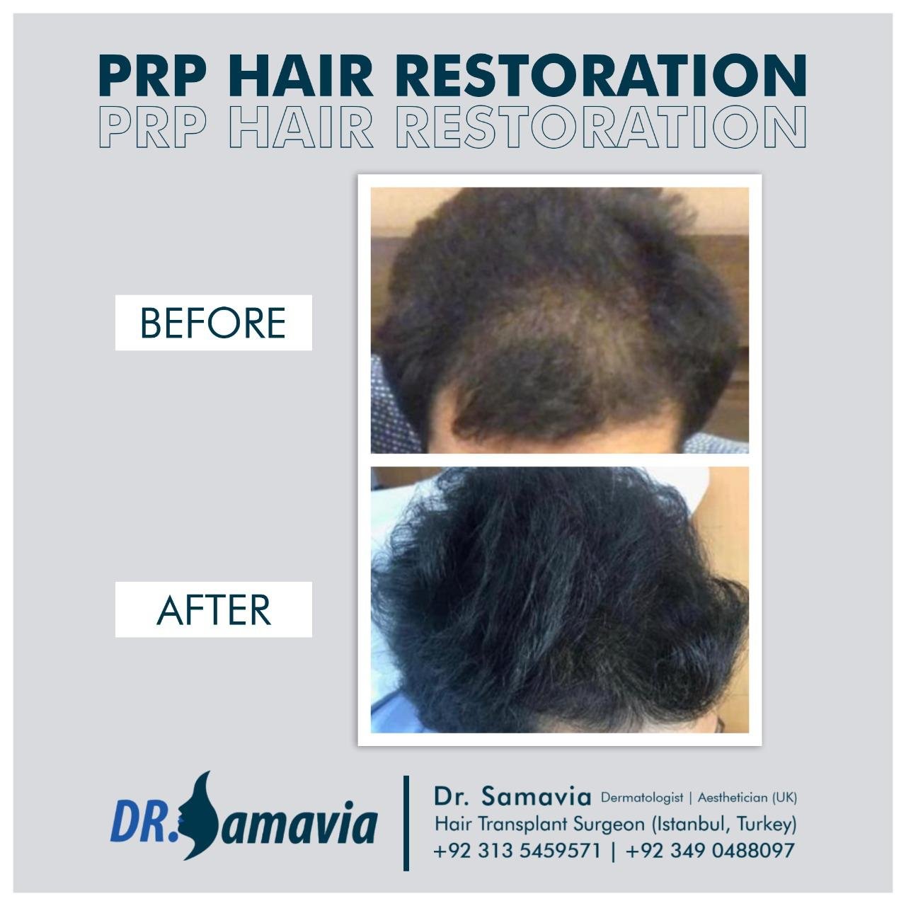 Before and after treatment result 11