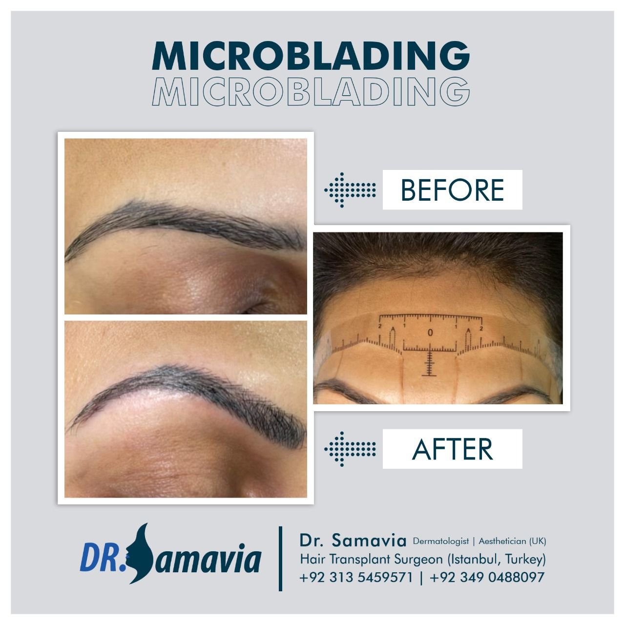 Before and after treatment result 2