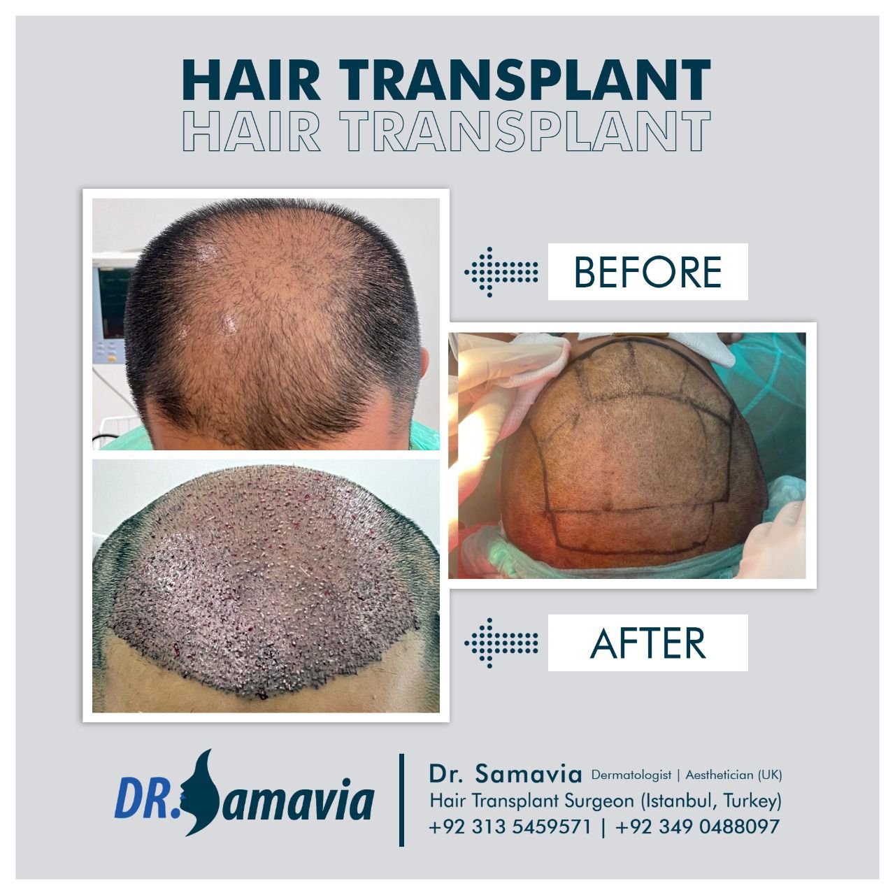 Before and after treatment result 3