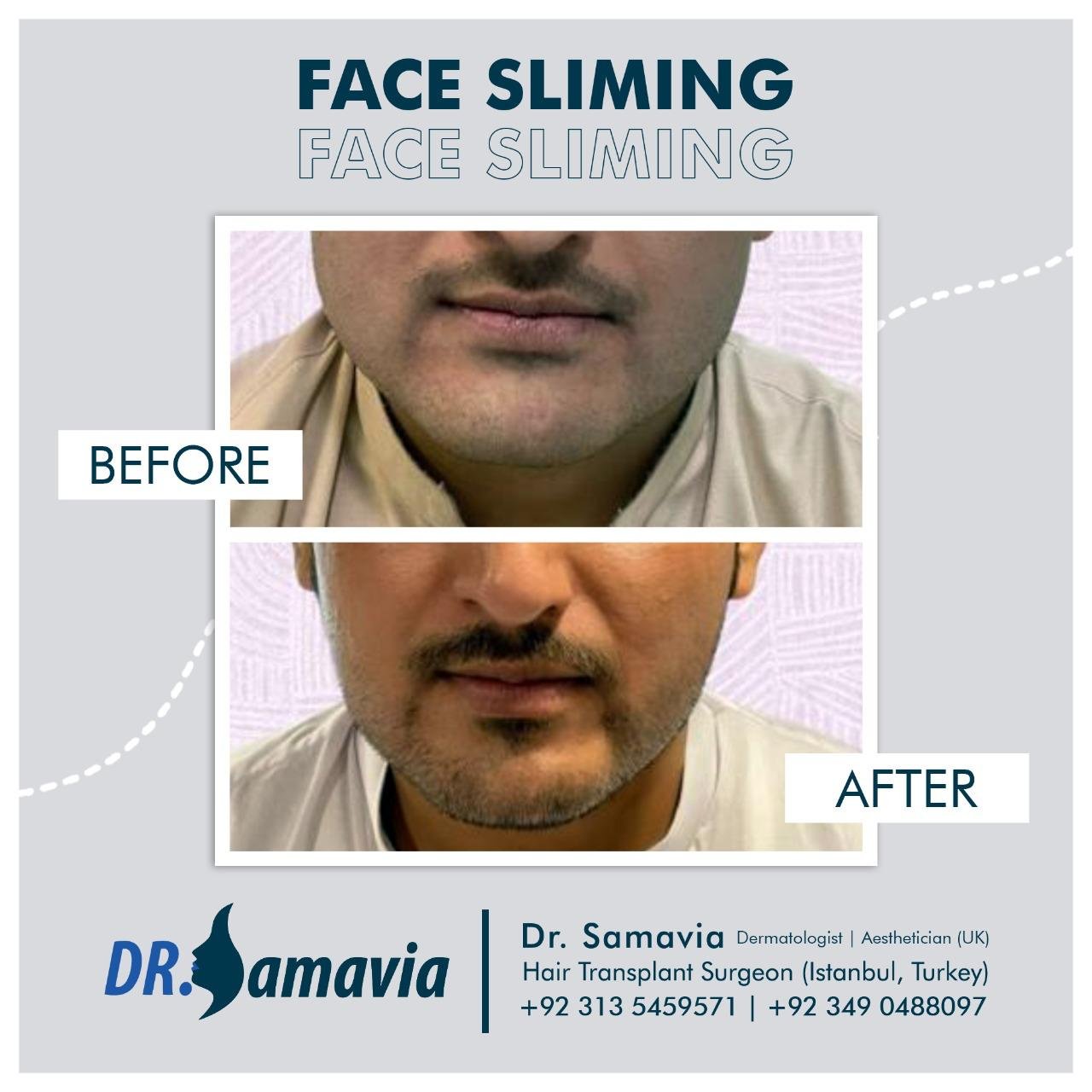 Before and after treatment result 4