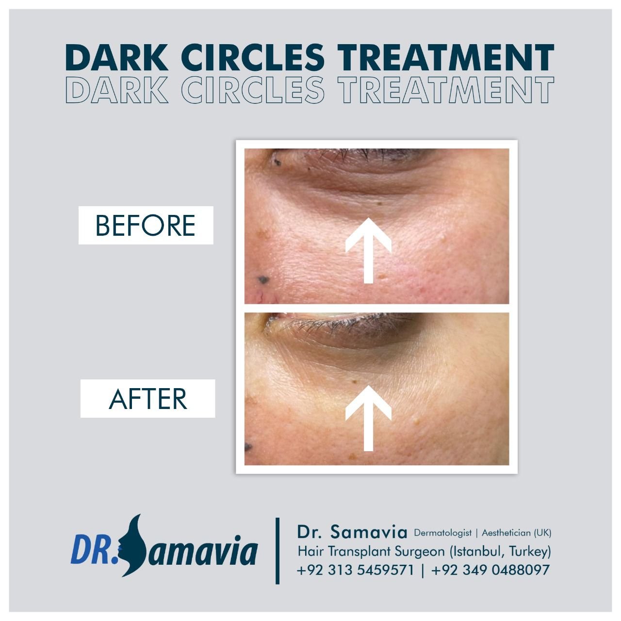 Before and after treatment result 5