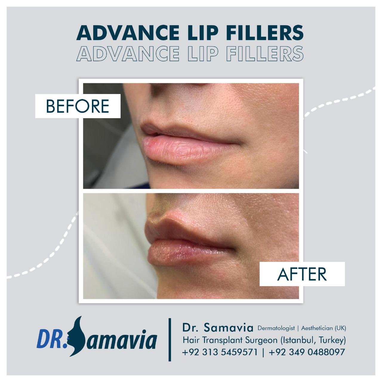 Before and after treatment result 6
